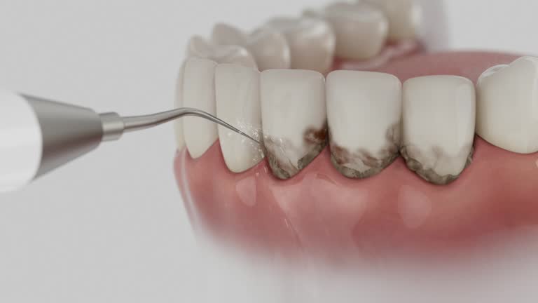 Trusted Dental Crowns And Bridges service in Trion, GA - Dentist Open Now